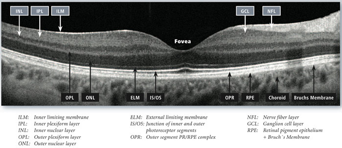 Retina-Optometrist-Calgary